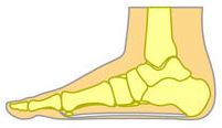 Pes planus - platvoet